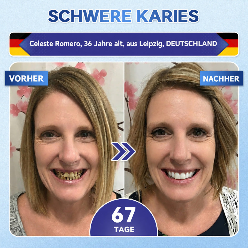 GarageLine®🦷 Tideglusib Zahn- & Zahnfleisch-NanoRepair Auflösende Whitening-Streifen ✨ (Unterstützt die Zahnreparatur und hilft, Zahnfleischbeschwerden sowie andere häufige Mundprobleme zu lindern)
