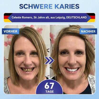 GarageLine®🦷 Tideglusib Zahn- & Zahnfleisch-NanoRepair Auflösende Whitening-Streifen ✨ (Unterstützt die Zahnreparatur und hilft, Zahnfleischbeschwerden sowie andere häufige Mundprobleme zu lindern)