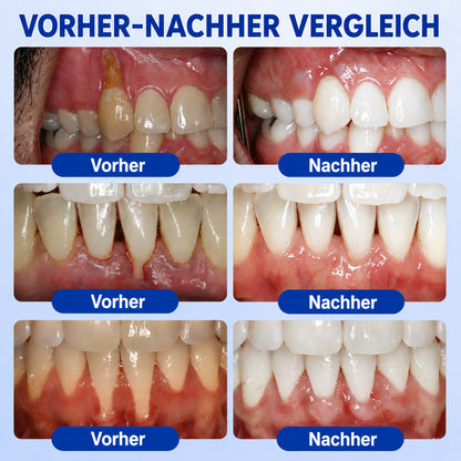 🇩🇪👨‍⚕️🦷🛡️ HEATWOLF® GumRevive – Parodontales Regenerationsgel🐟