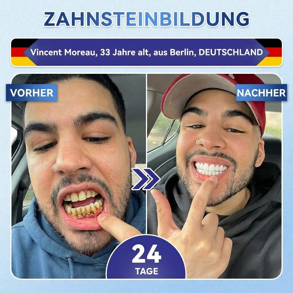 GarageLine®🦷 Tideglusib Zahn- & Zahnfleisch-NanoRepair Auflösende Whitening-Streifen ✨ (Unterstützt die Zahnreparatur und hilft, Zahnfleischbeschwerden sowie andere häufige Mundprobleme zu lindern)