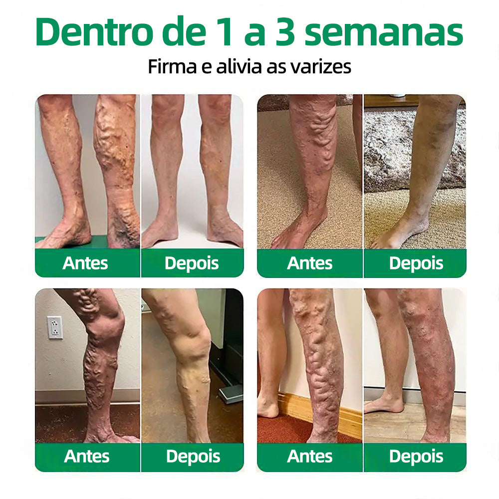 🇵🇹👨‍⚕️✅Healrize® VeinTarget Microneedle Patch⚡Alívio Instantâneo, Resultados Duradouros🤠