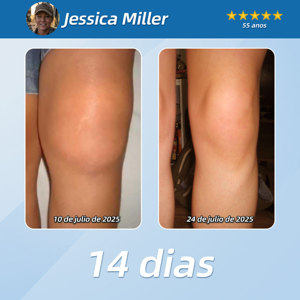 Loção Analgésica e Restauradora CureVivo®🐰Para dores musculares, articulares e nervosas（葡萄牙）