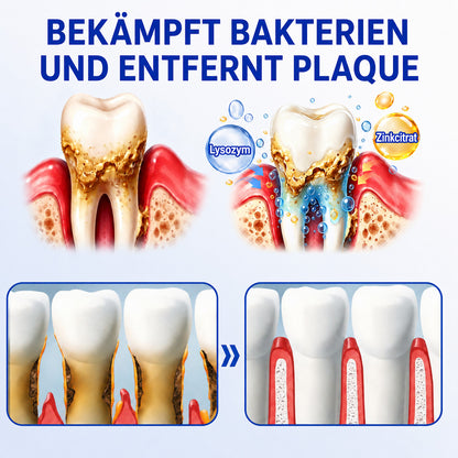 🇩🇪👨‍⚕️🦷🛡️ HEATWOLF® GumRevive – Parodontales Regenerationsgel🐟