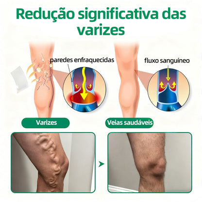 🇵🇹👨‍⚕️✅Healrize® VeinTarget Microneedle Patch⚡Alívio Instantâneo, Resultados Duradouros🤠