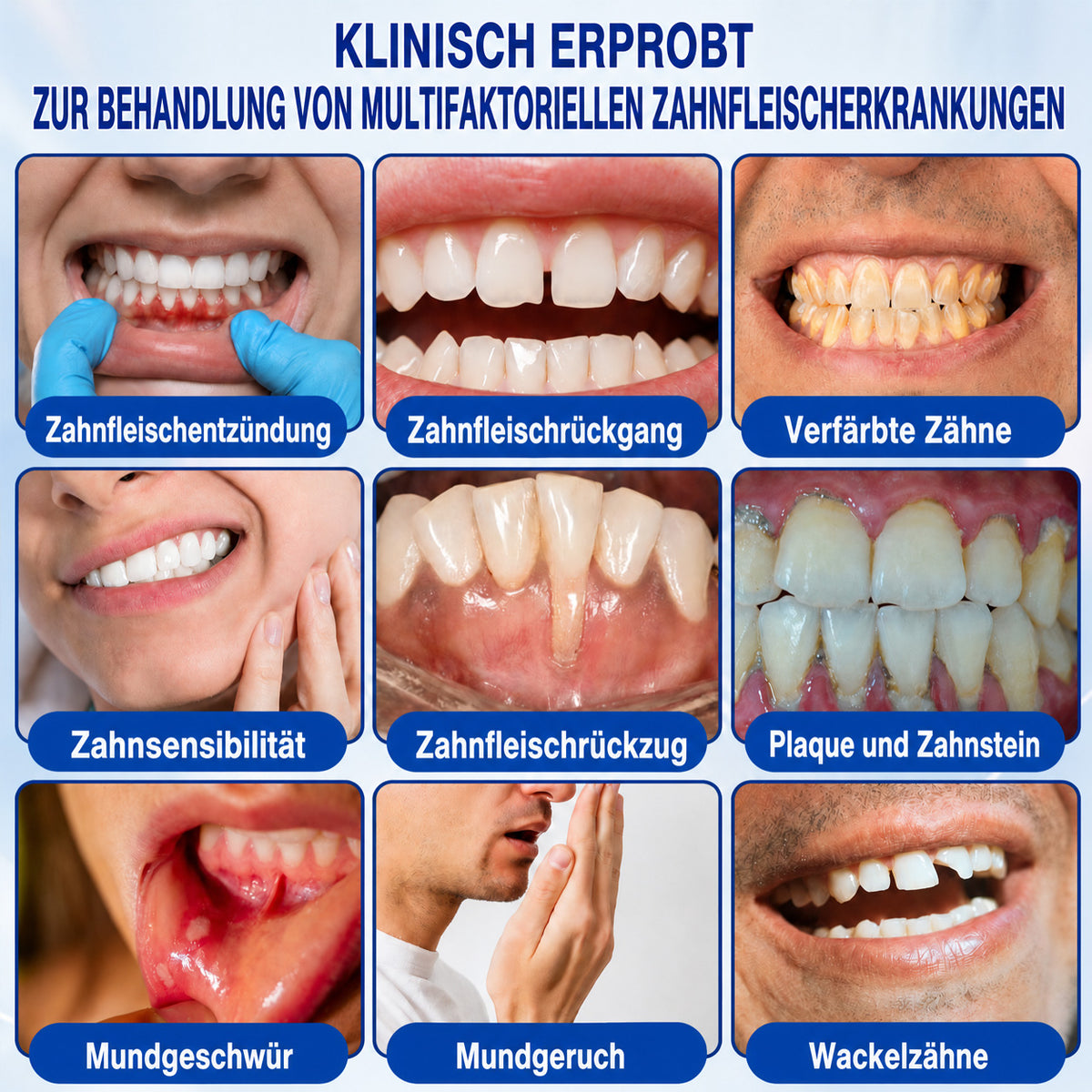 🇩🇪👨‍⚕️🦷🛡️ HEATWOLF® GumRevive – Parodontales Regenerationsgel🐟