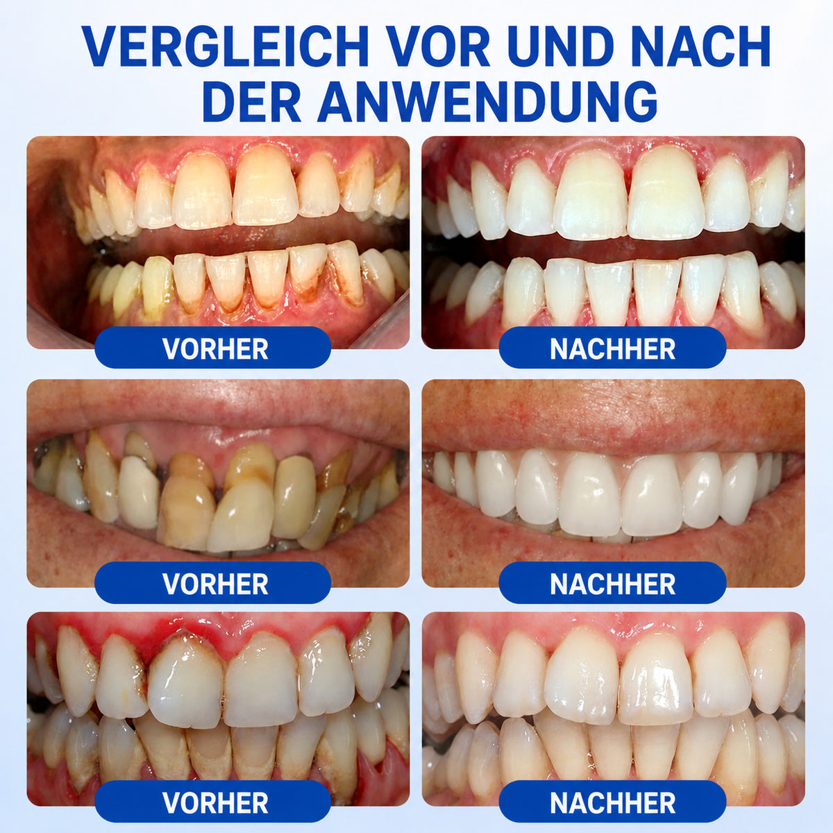 🇩🇪👨‍⚕️🦷🛡️ HEATWOLF® GumRevive – Parodontales Regenerationsgel🐟
