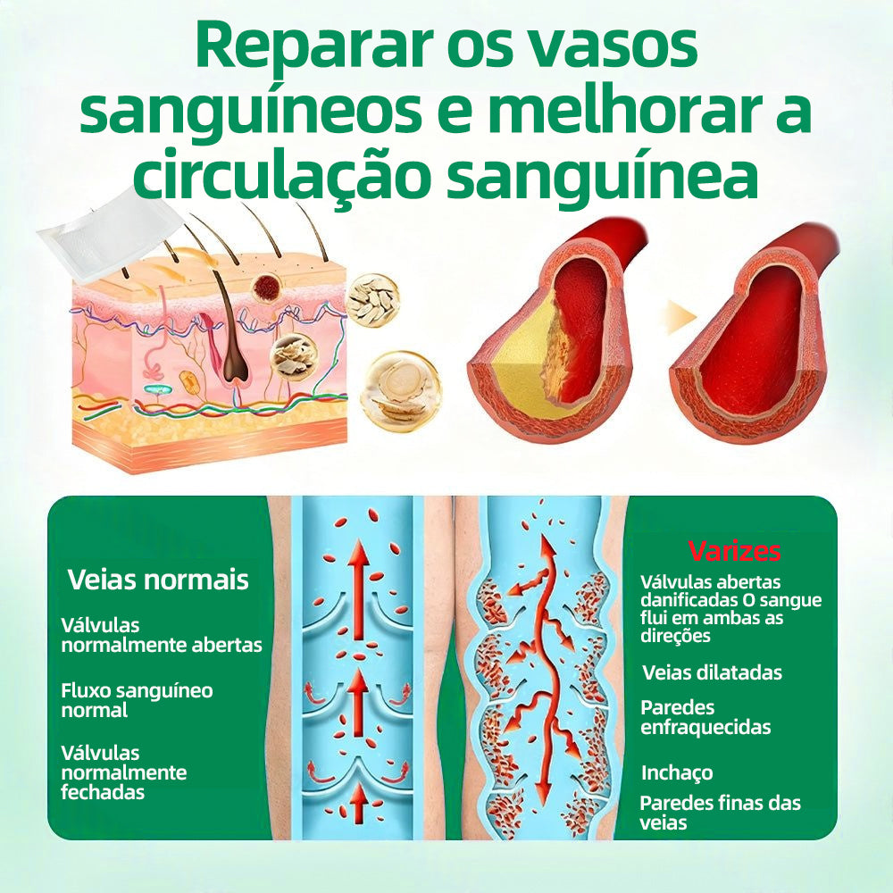🇵🇹👨‍⚕️✅Healrize® VeinTarget Microneedle Patch⚡Alívio Instantâneo, Resultados Duradouros🤠